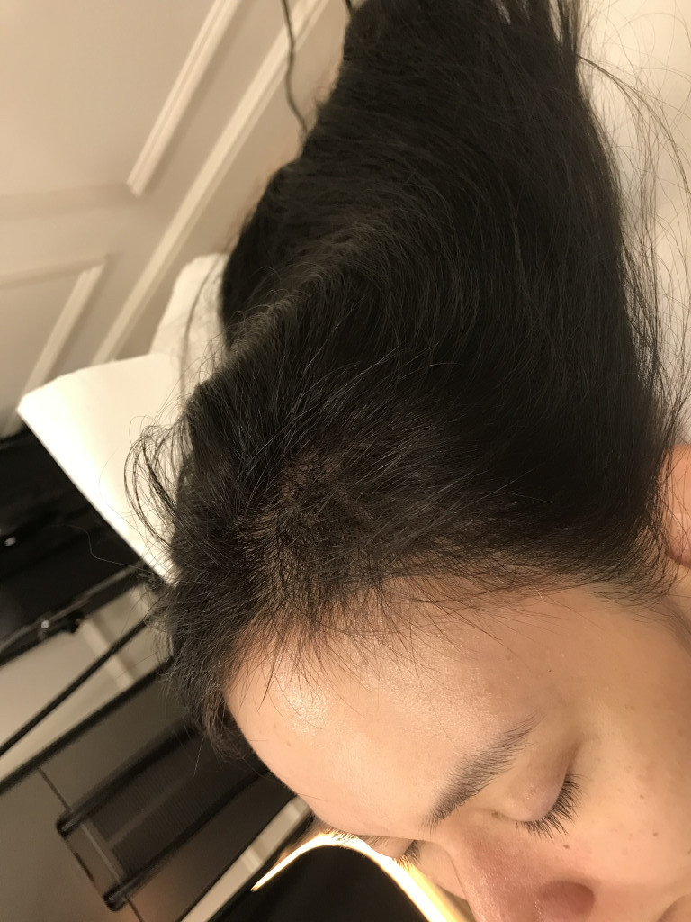 after-img-2
