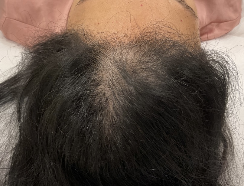 before-img-1